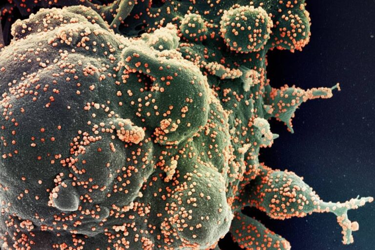 Pesquisa: anticorpos de pessoas internadas com Covid-19 são mais “potentes”