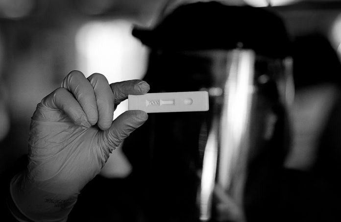 Mato Grosso registra queda em incidência e óbitos de covid-19