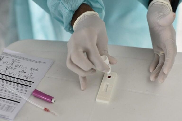 IgG positivo: entenda o que significa o resultado no exame de Covid-19