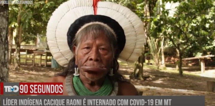 TBO 90 Segundos: Cacique reconhecido internacionalmente segue internado em Sinop