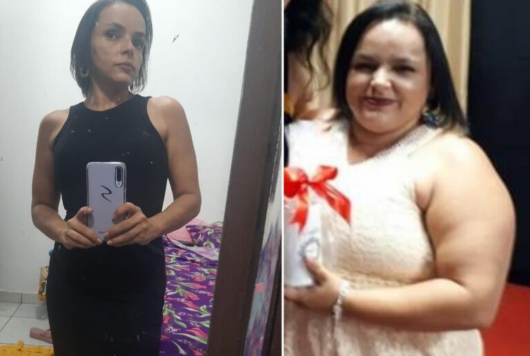 Nasceu uma nova Juliana após a bariátrica, afirma professora de Tangará da Serra (MT)
