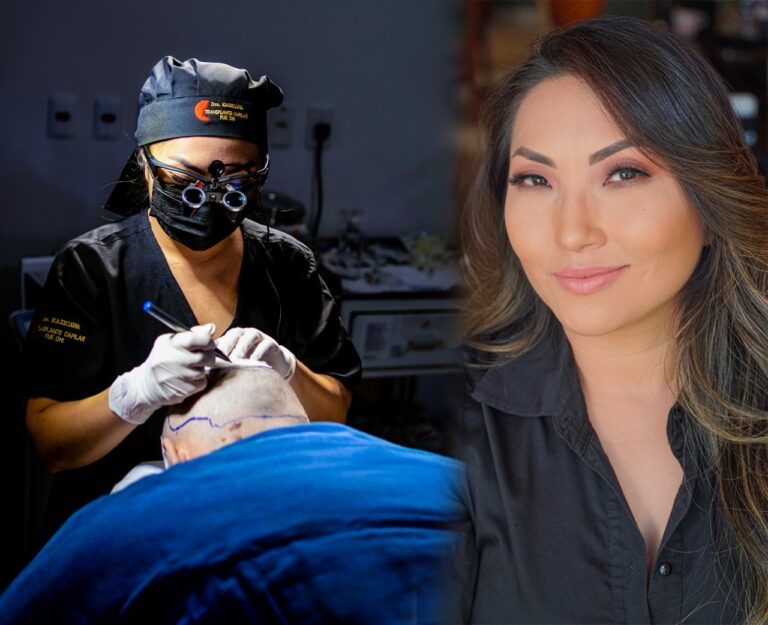 Médica de Sinop realiza técnica inovadora de transplante capilar